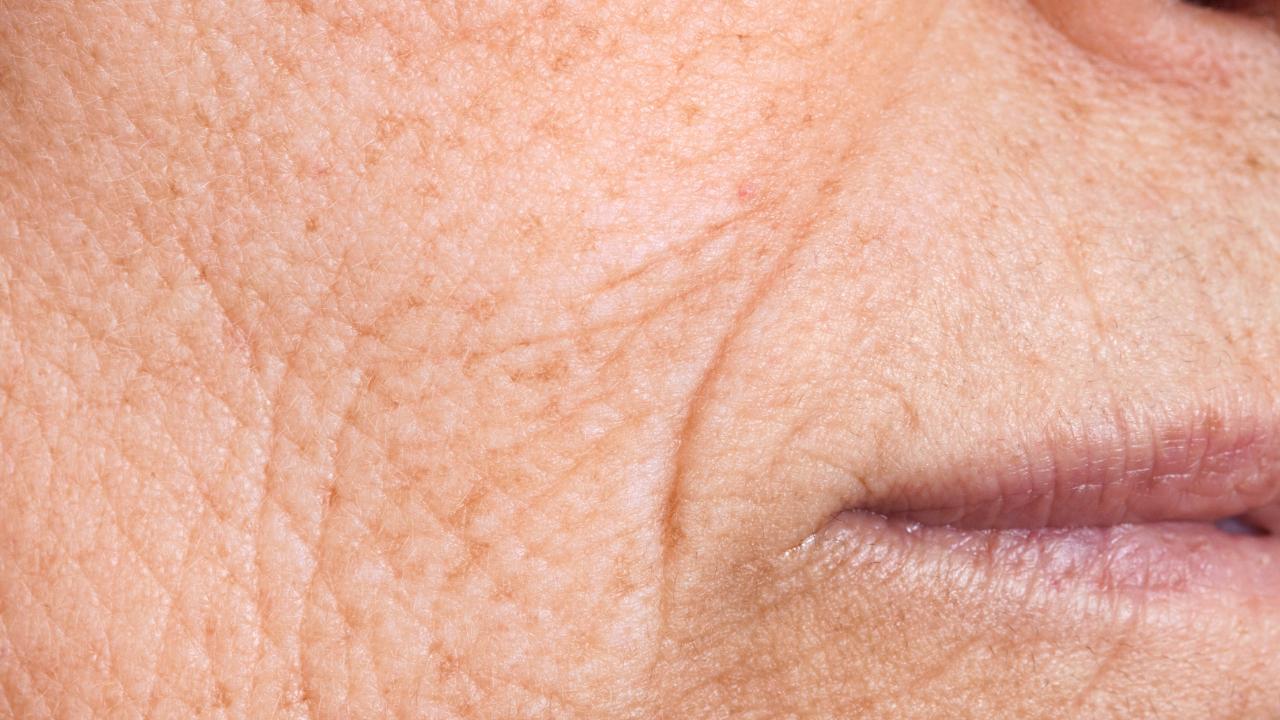 Fights Signs of Premature Ageing