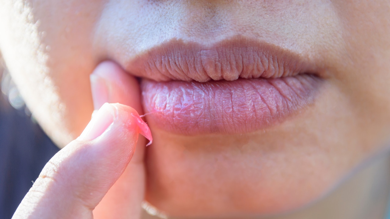 Promotes Healing of Damaged Skin: