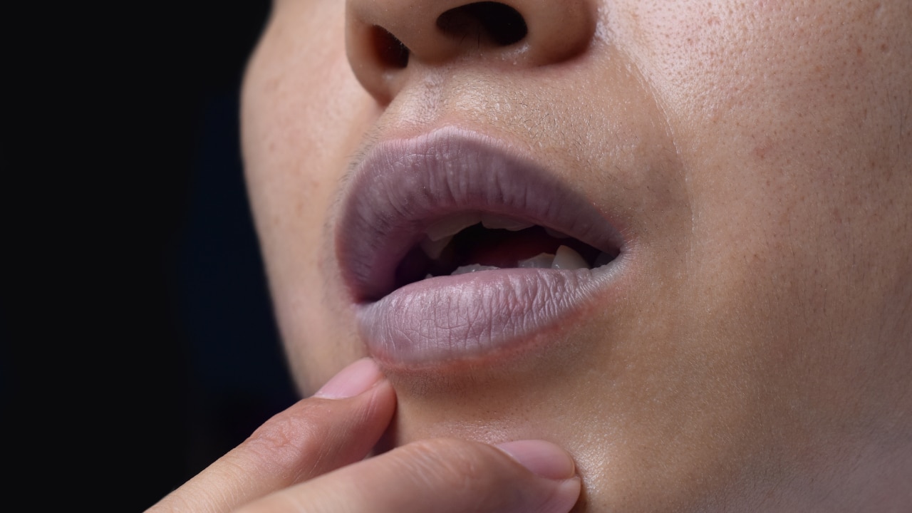 Reduces the Appearance of Darkening: