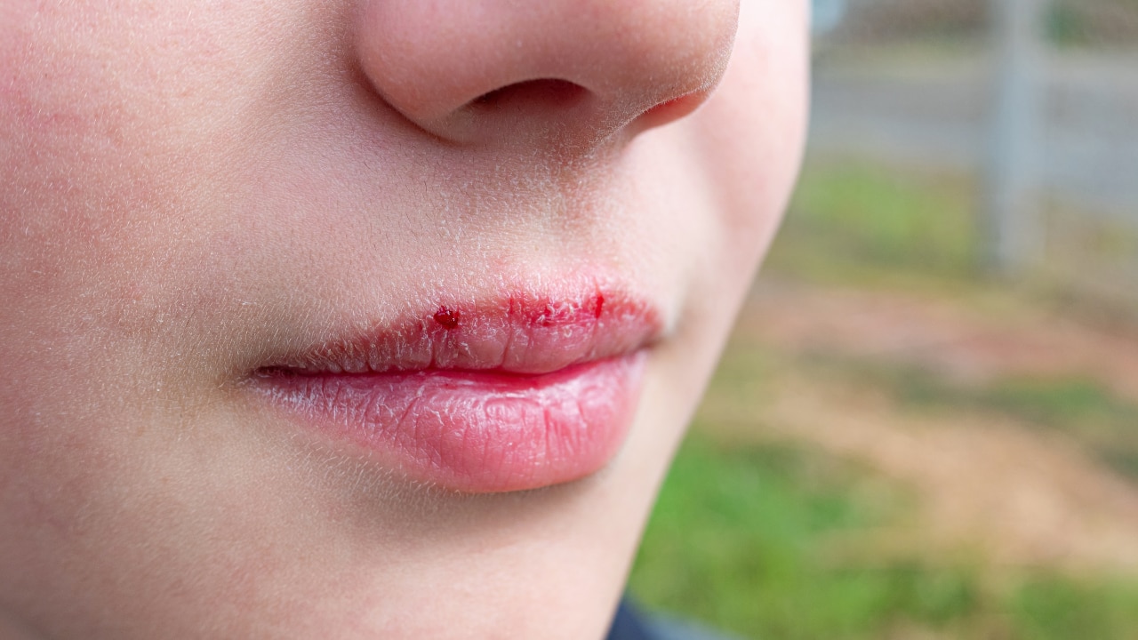 Soothes Discomfort and Irritation: