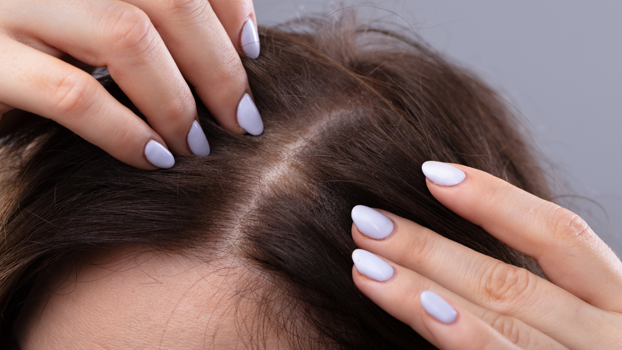 Strengthens Hair Roots: