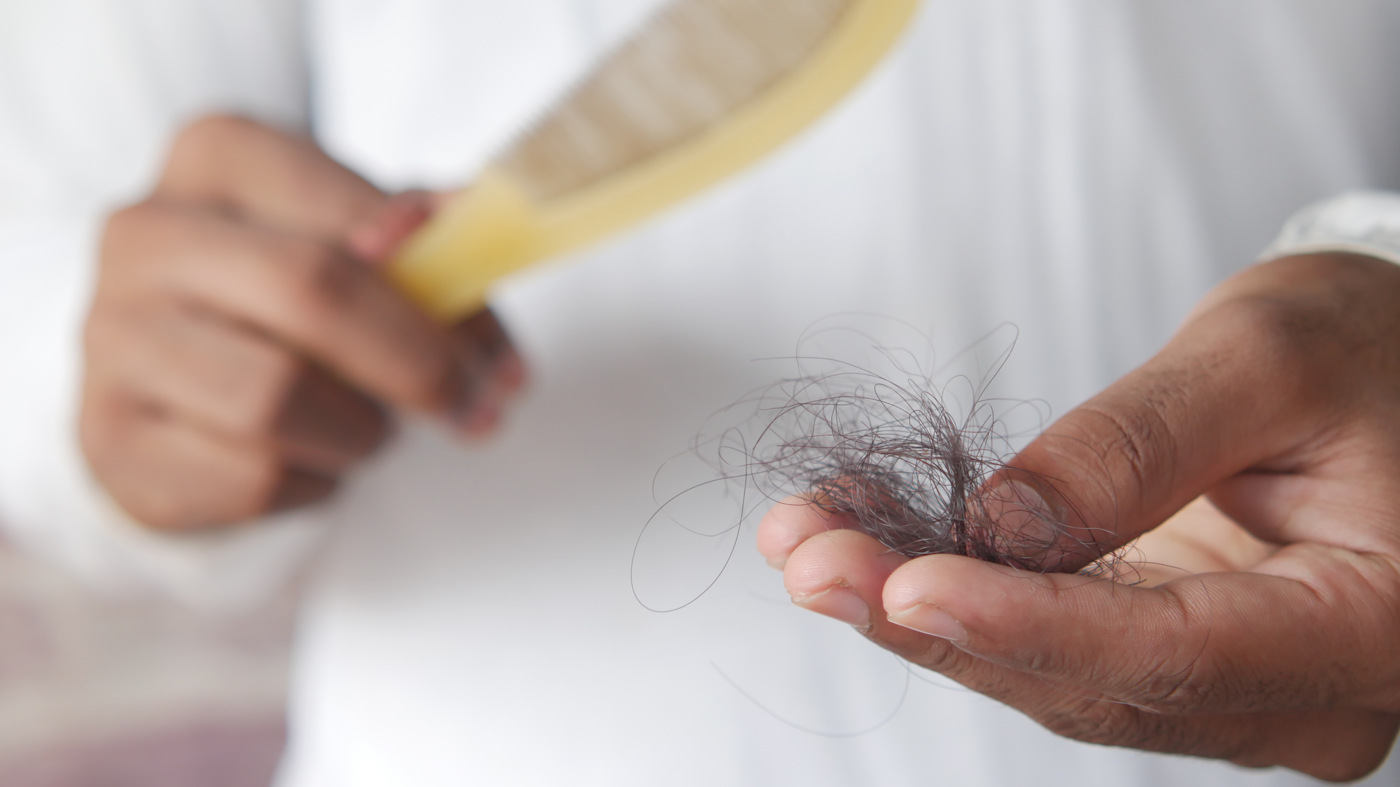 Common Hair Problems Men Face (and Fixes)