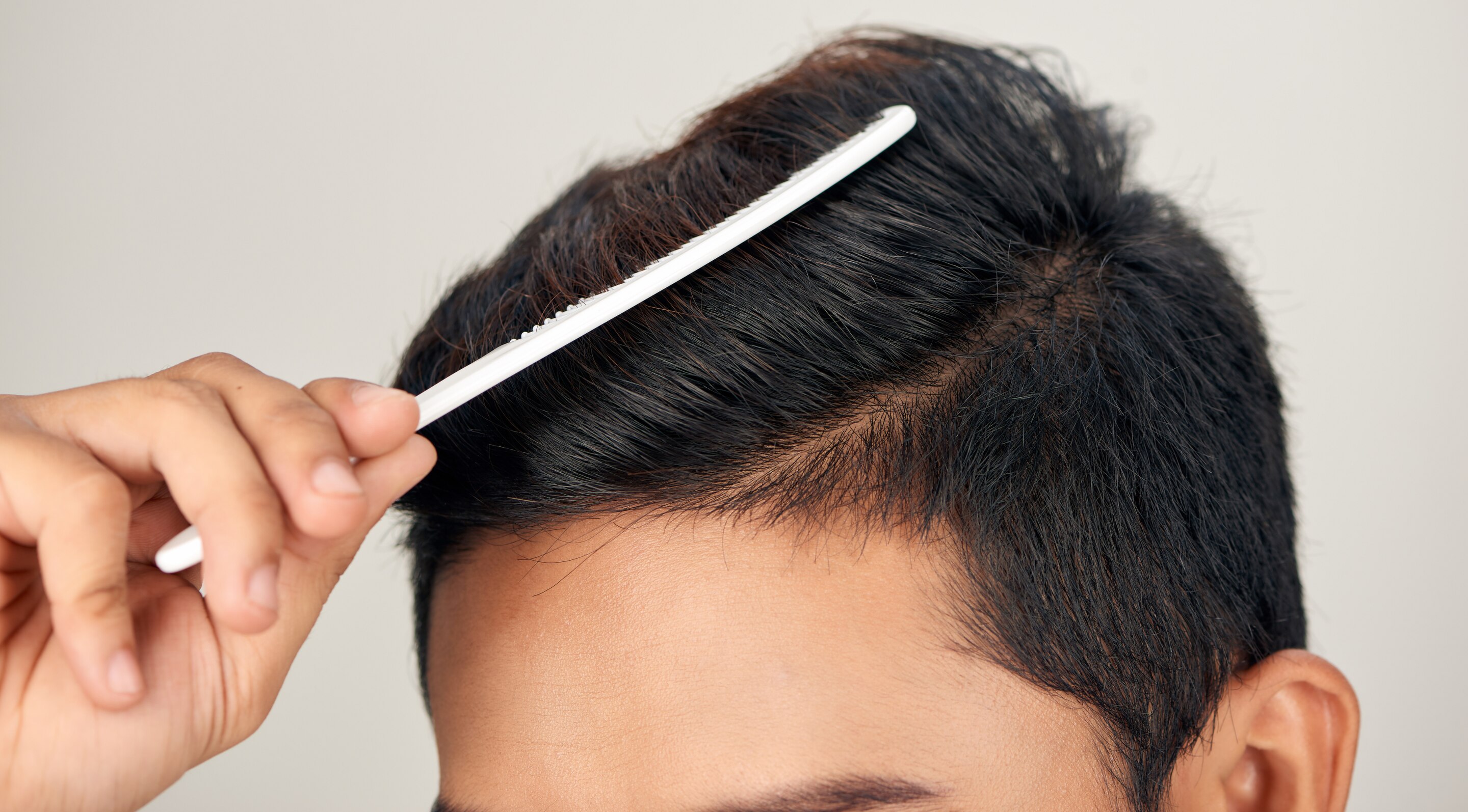 Understanding Men’s Hair Types