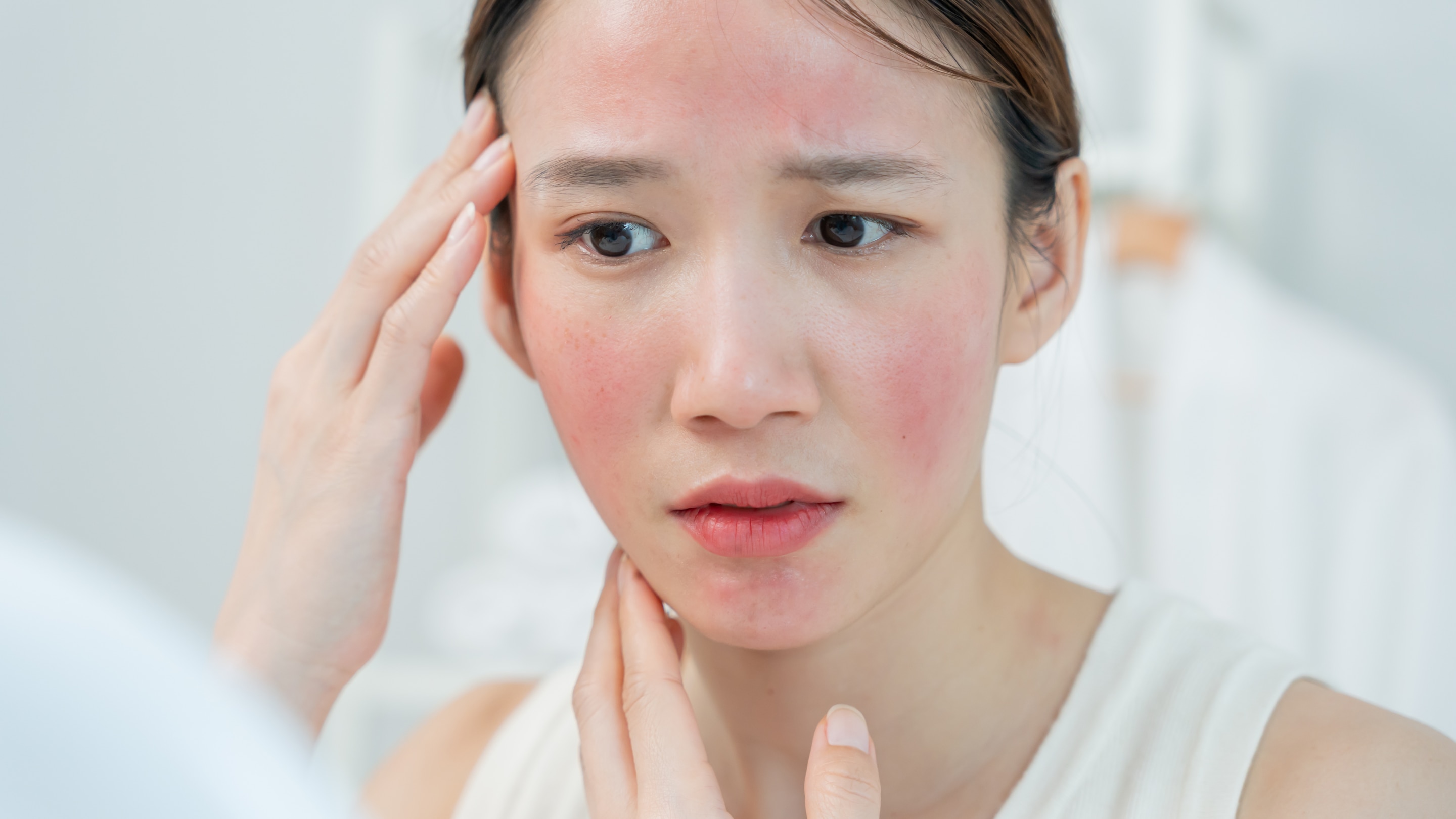 4. Soothes Sunburn and Irritation: