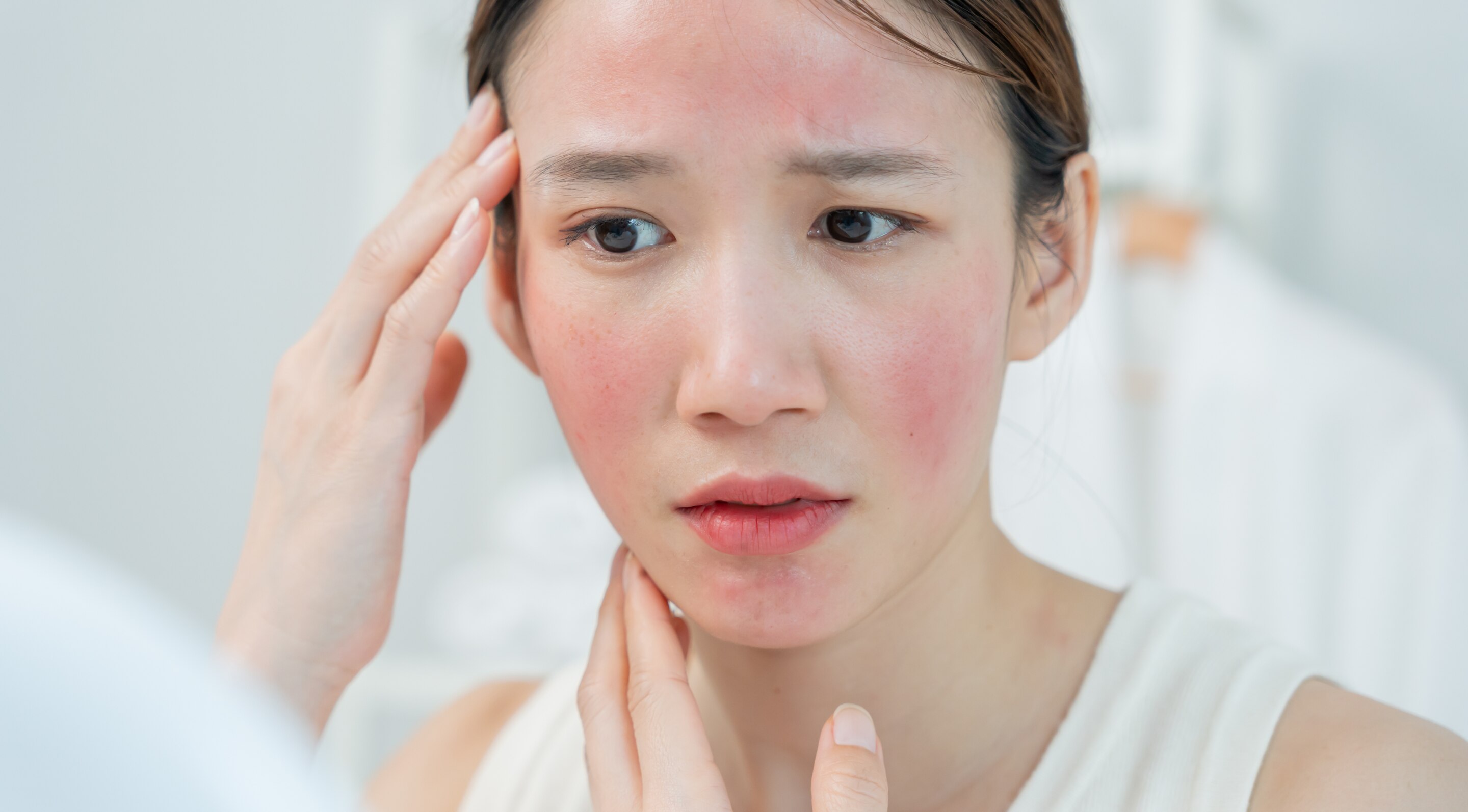 4. Soothes Sunburn and Irritation:
