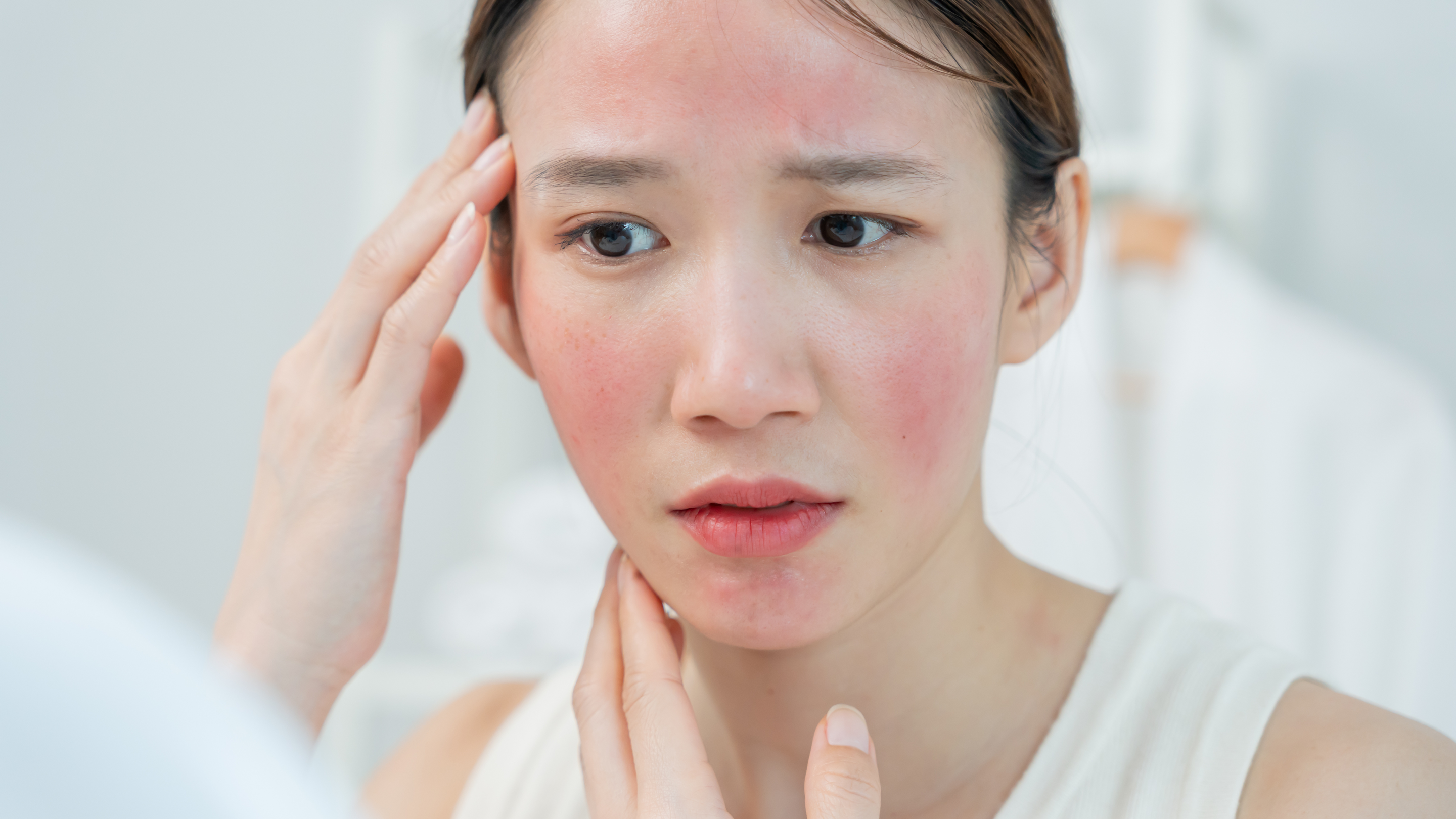 4. Soothes Sunburn and Irritation: