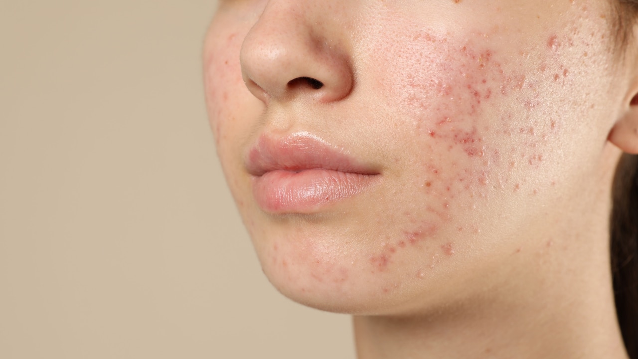 Cheeks – Respiration, Environment & Hygiene