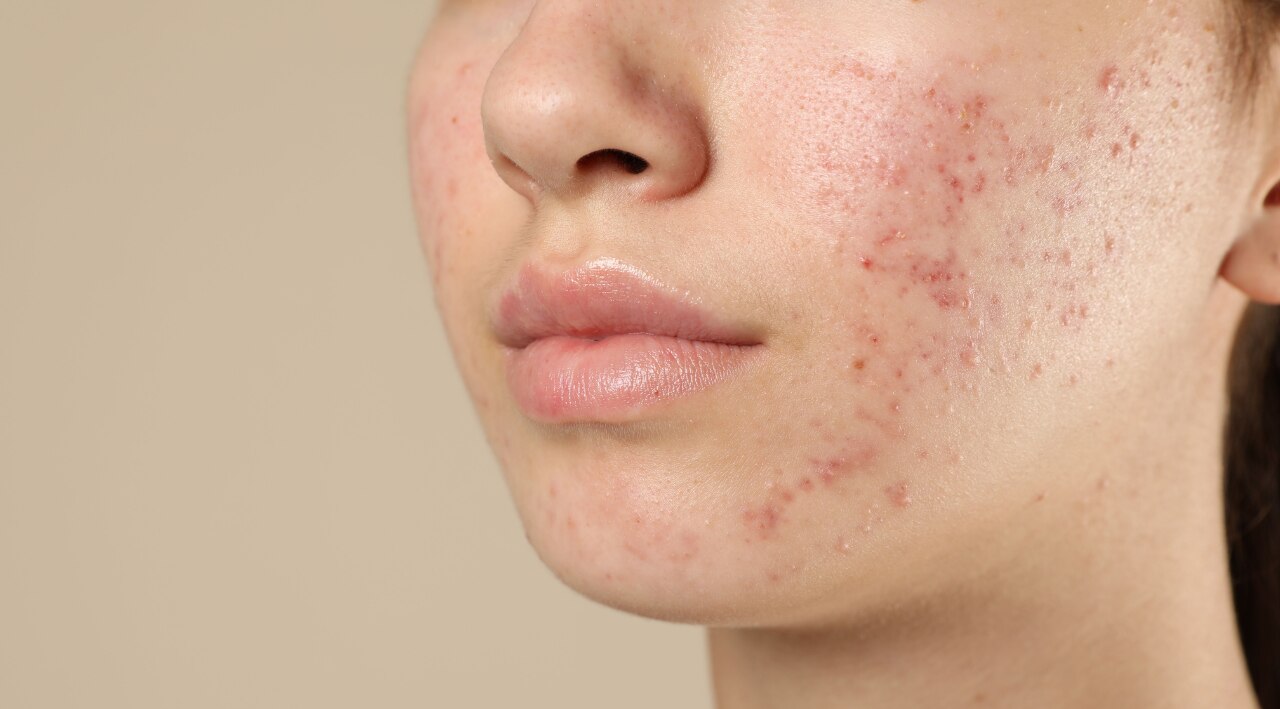 Cheeks – Respiration, Environment & Hygiene