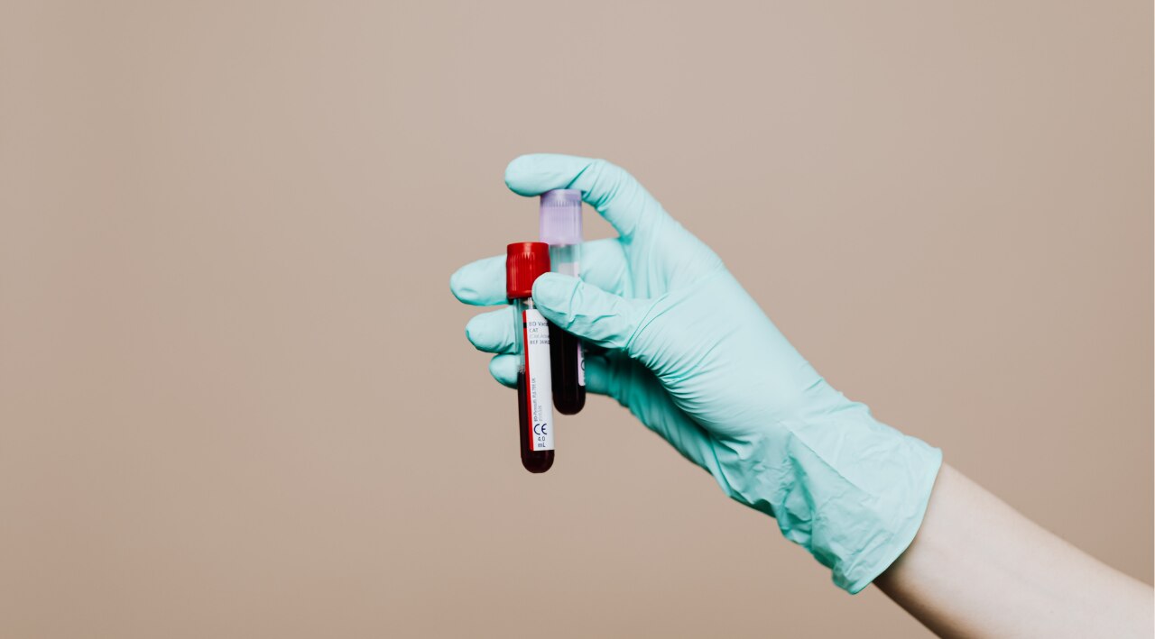 Blood Purification: