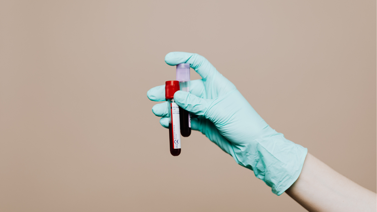 Blood Purification: