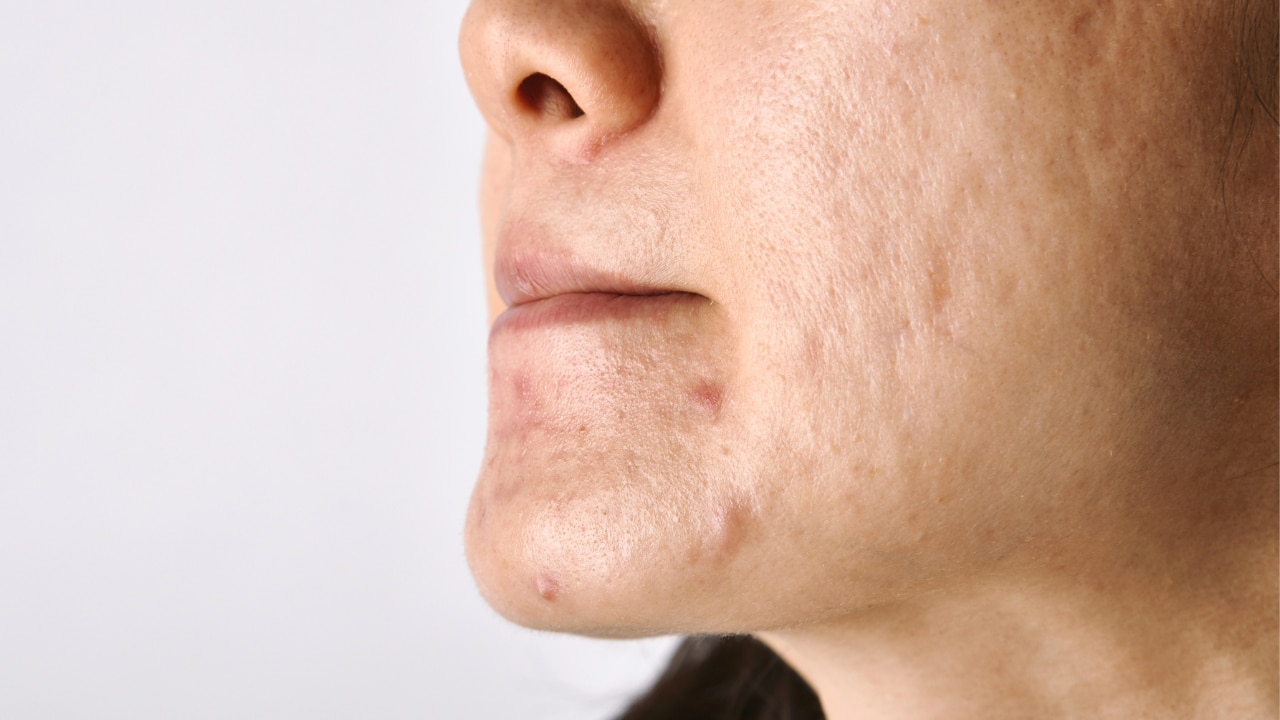 Fades Pigmentation and Dark Spots: