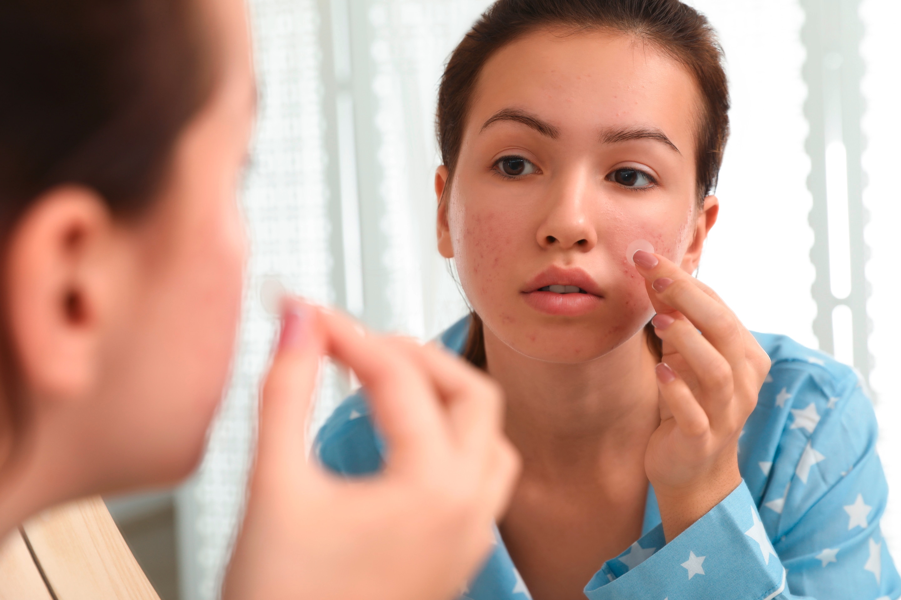 Young woman applying pimple patch on acne.