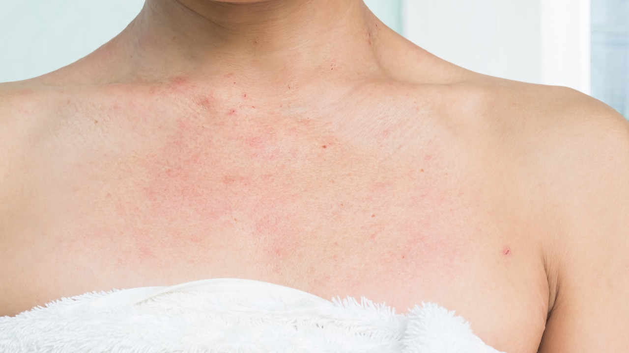 Soothes Inflammation: