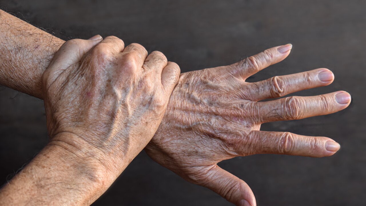 Reduces Age Spots: