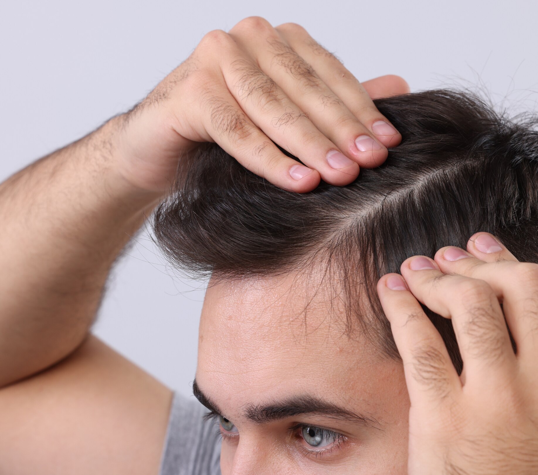 Image of How  to Stop Hair Fall for Men: Effective Natural Remedies & Proven Treatments