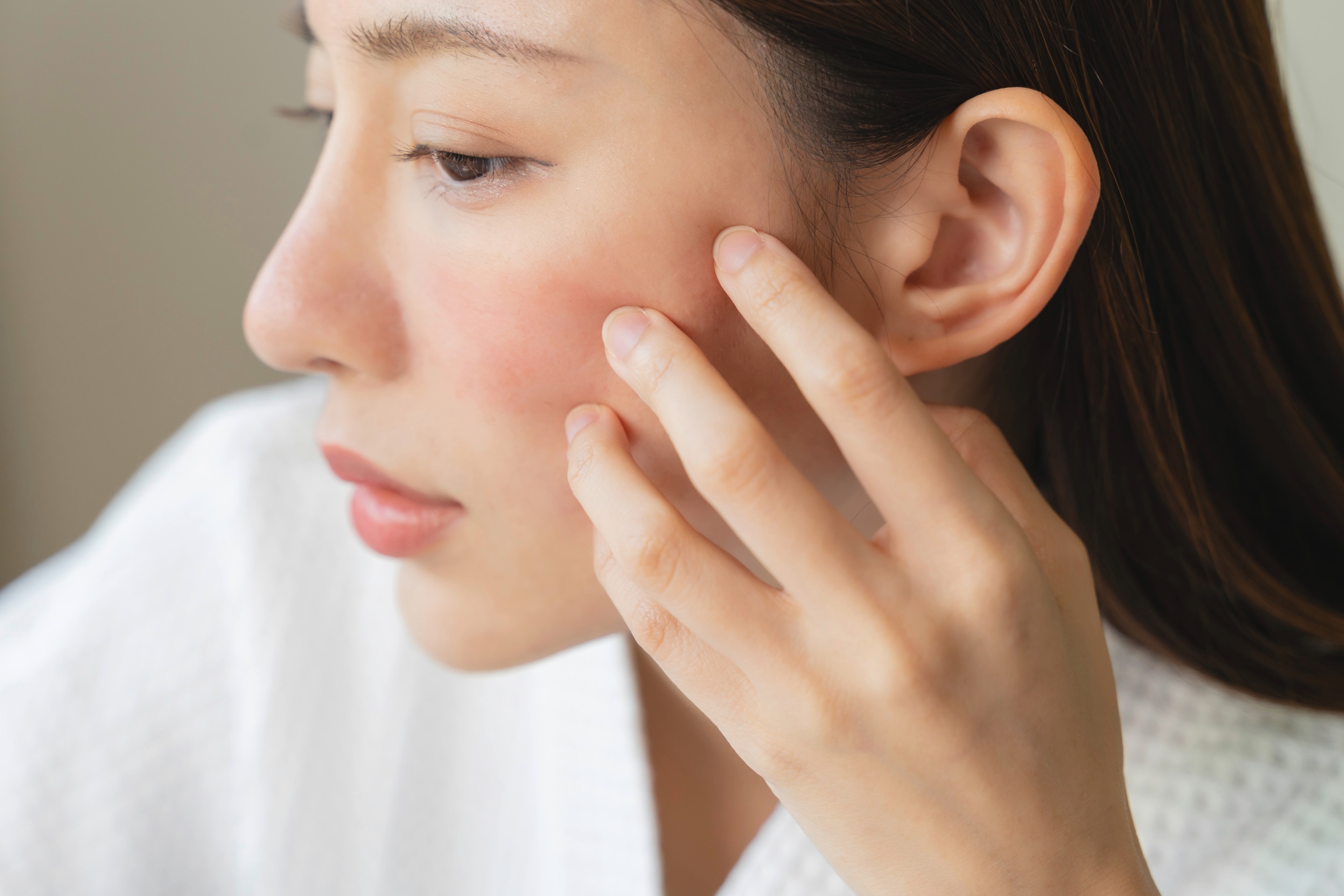 A woman examines her red, irritated skin.