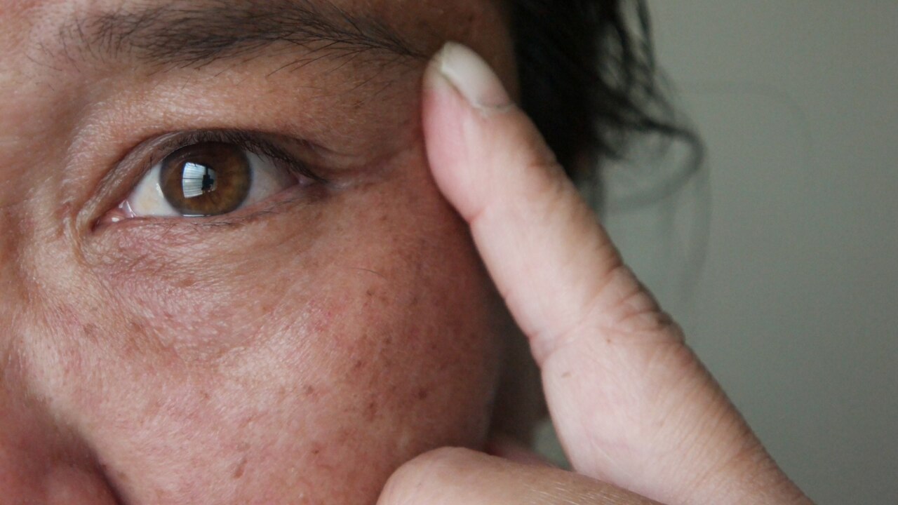 Minimises Post-Inflammatory Hyperpigmentation (PIH):