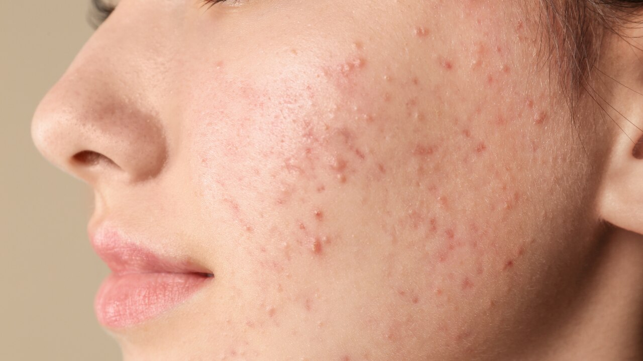 Breakouts