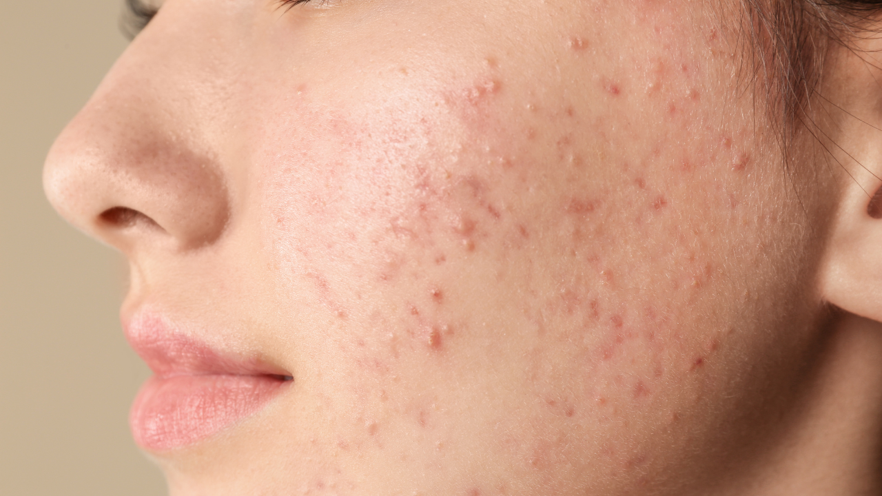 Breakouts