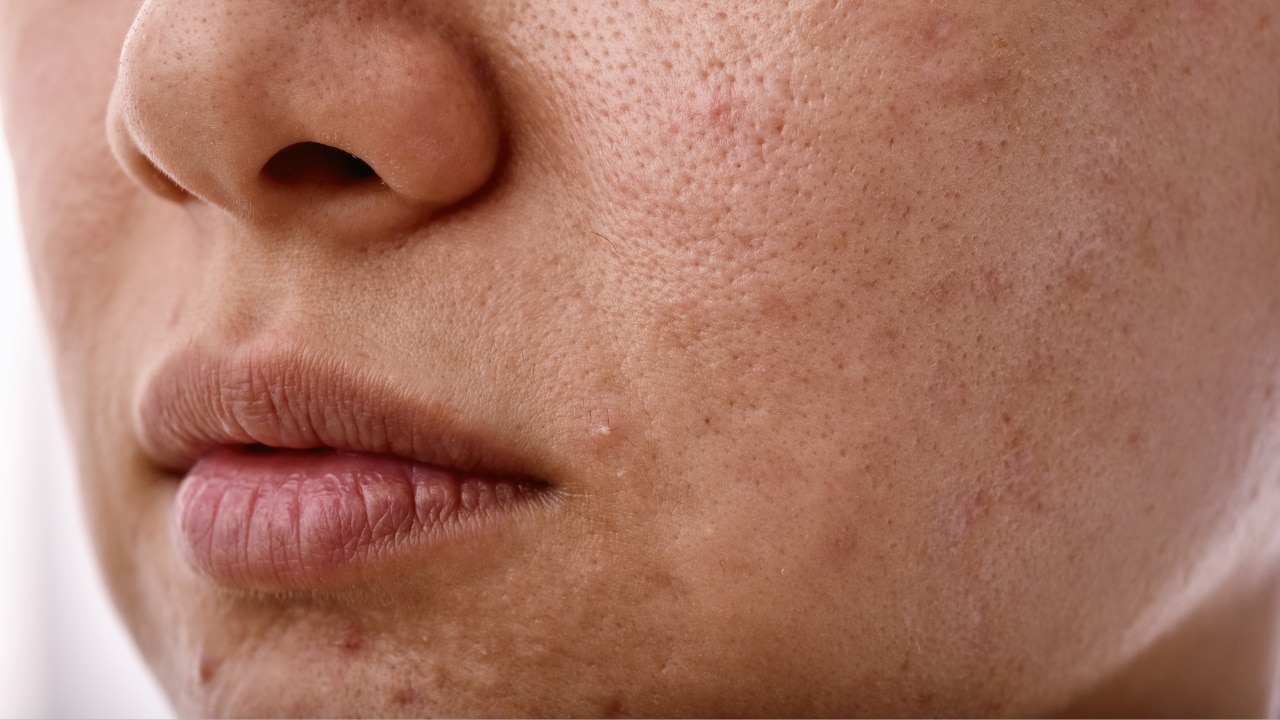 Tightness and dryness