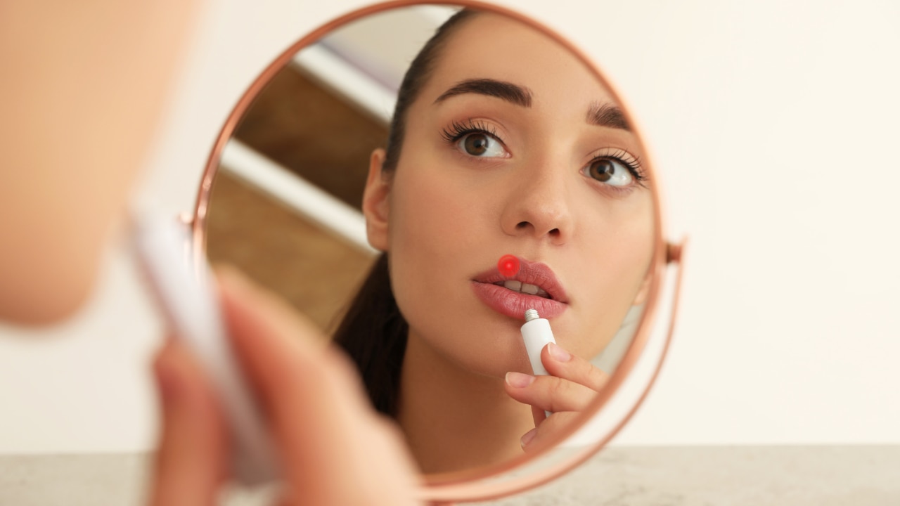 Home Remedies for Chapped Lips