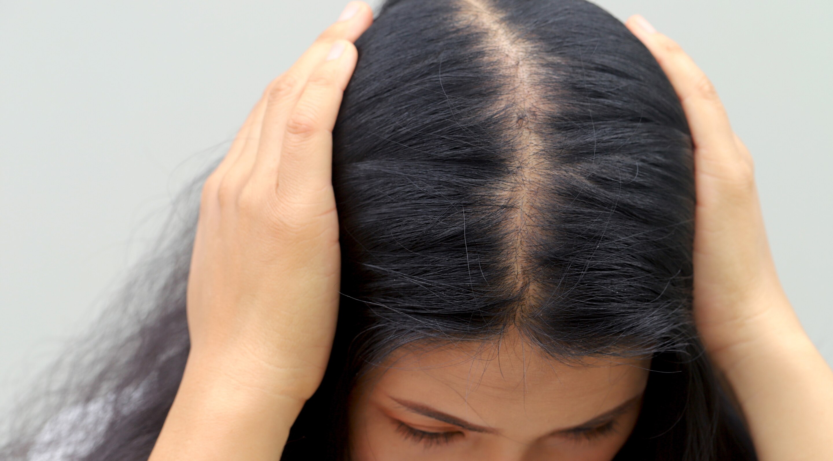 Delays Age-Related Hair Thinning