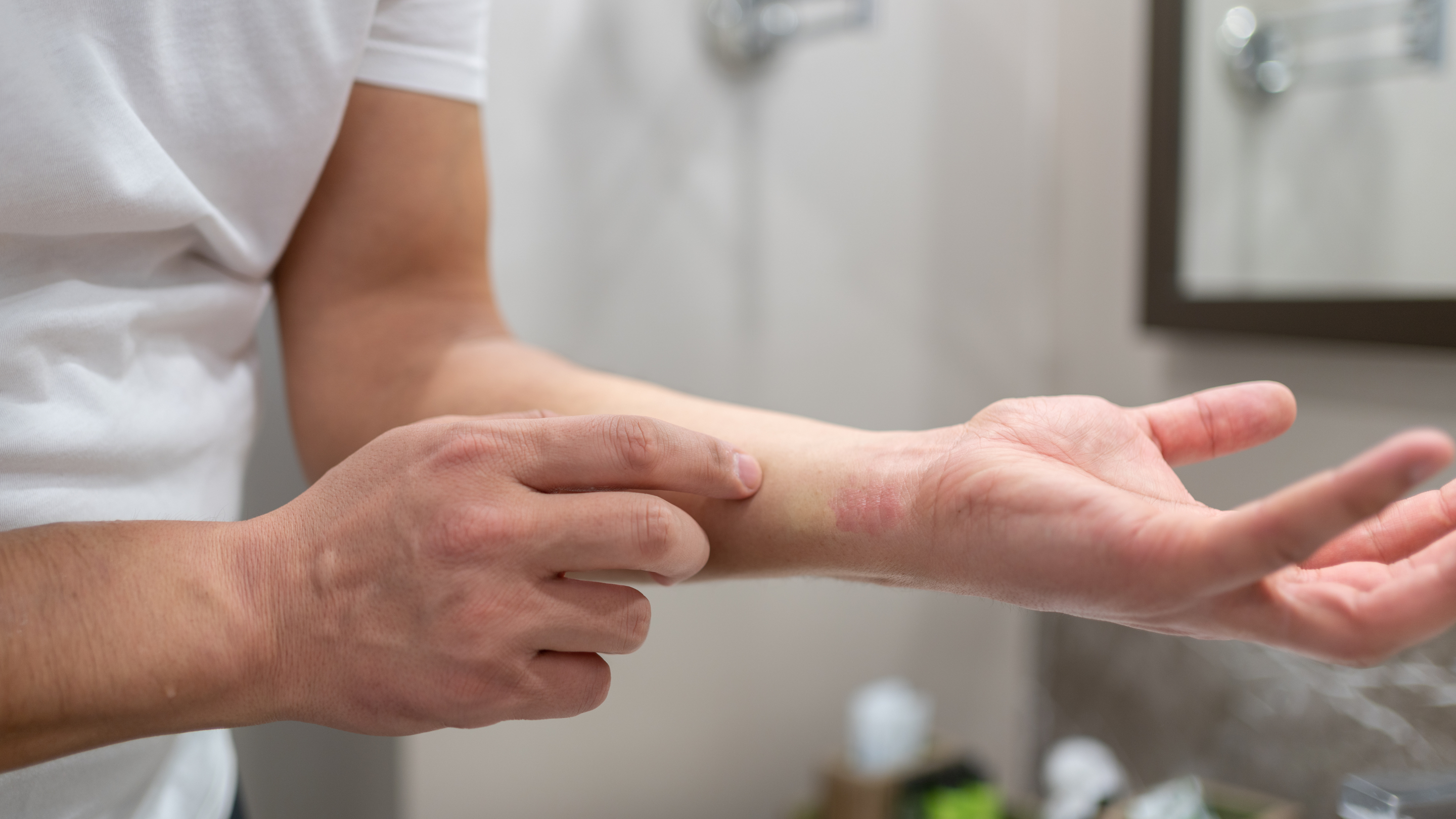Allergic Reactions: