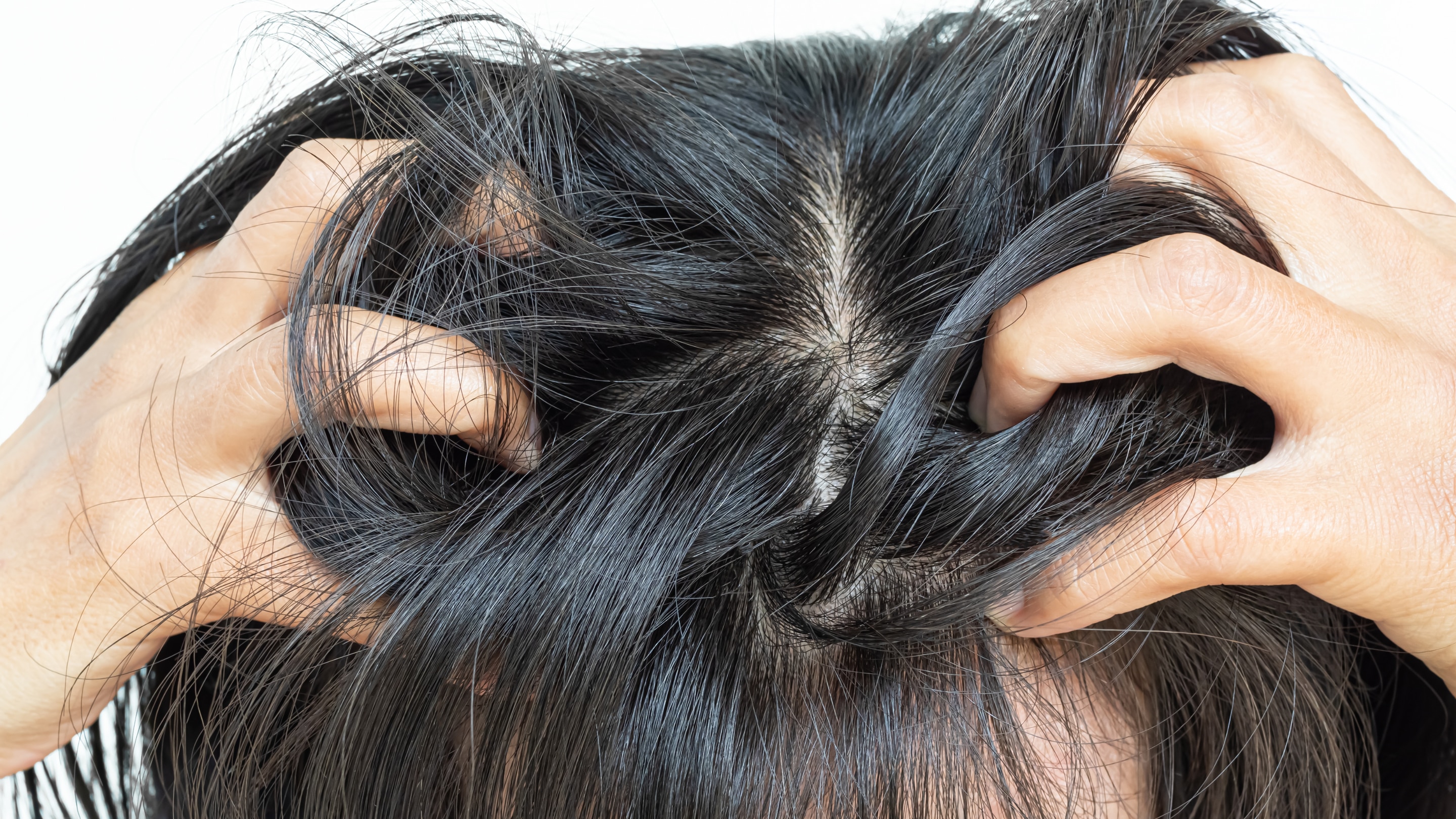 Mild Scalp Irritation: