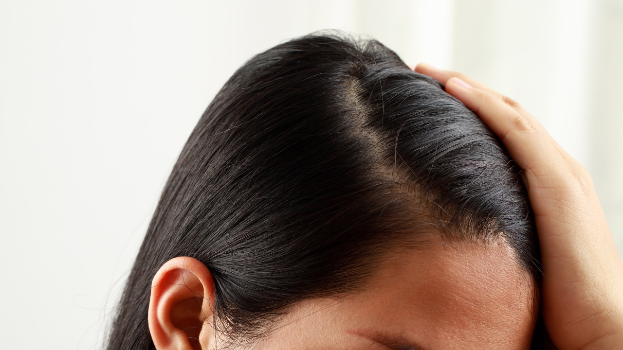 Start with a Clean Scalp: