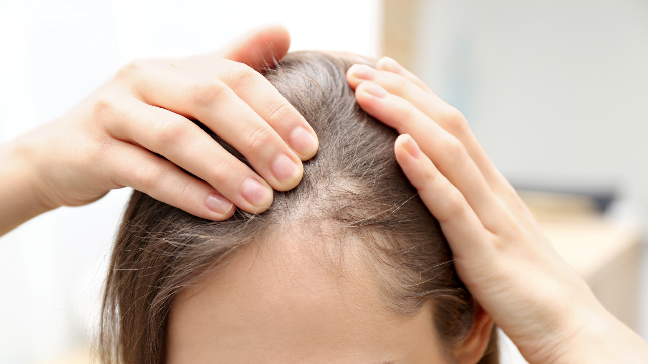 How Lice Spread
