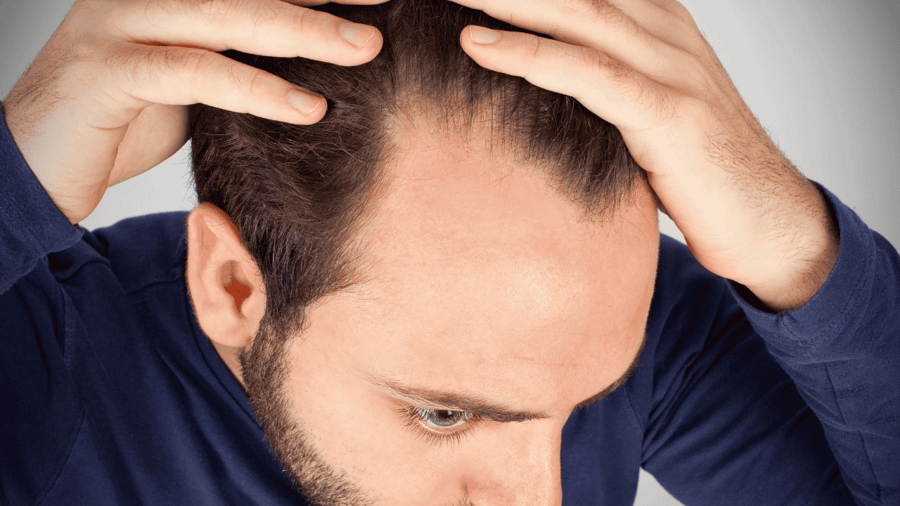How to Stop Hair Fall in Men with Medical Treatment