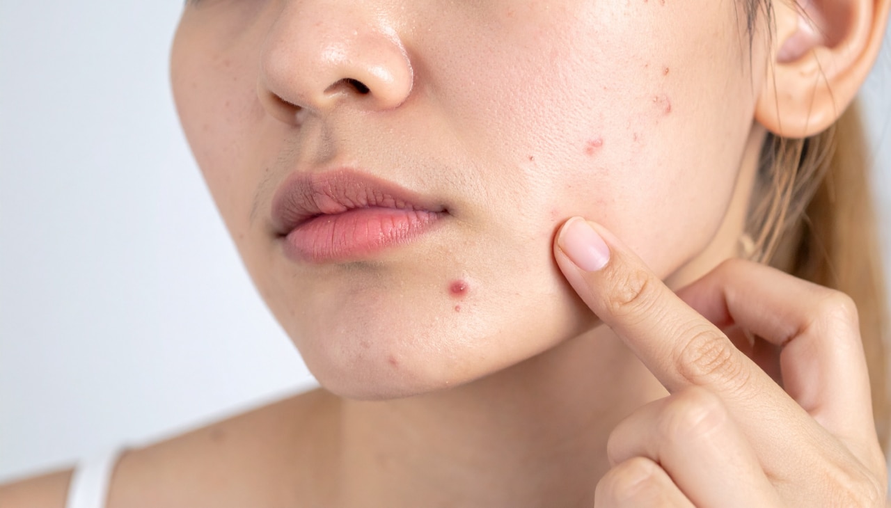 Targeted Spot Treatment: