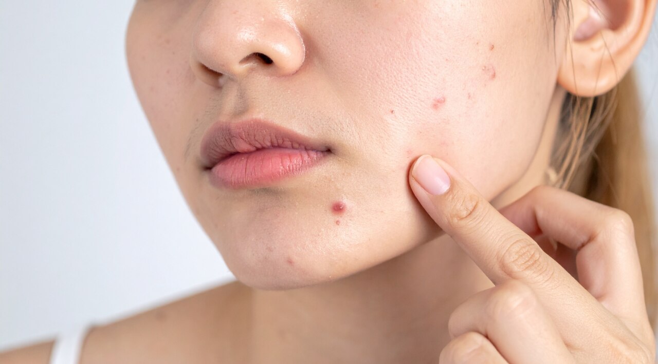 Targeted Spot Treatment:
