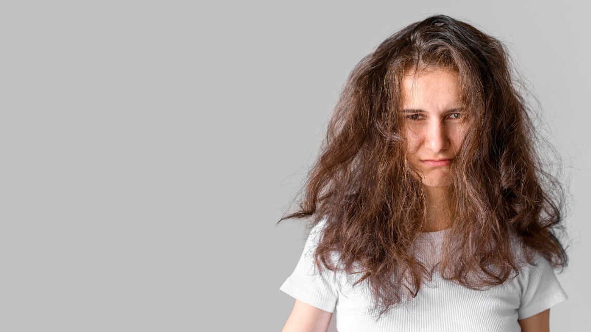 Image of Static Hair: Causes, Winter Triggers & Easy Remedies to Fix It Fast