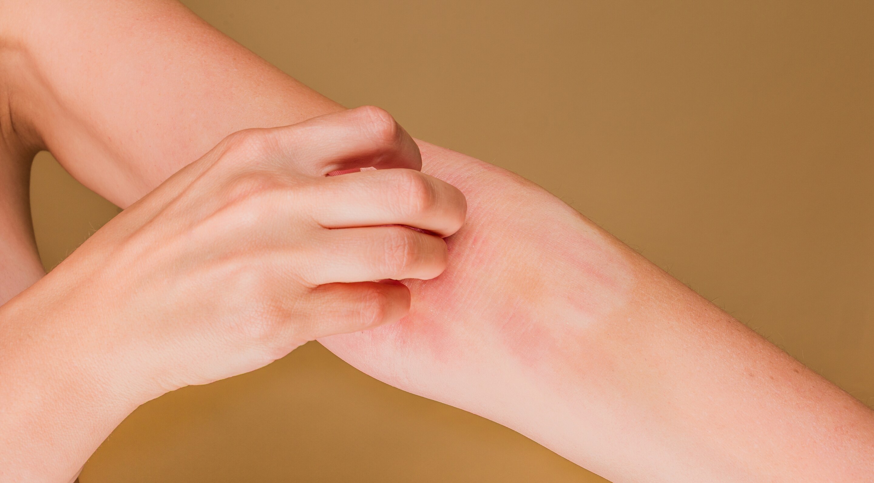 Aloe Vera Gel Side Effects & When to Avoid