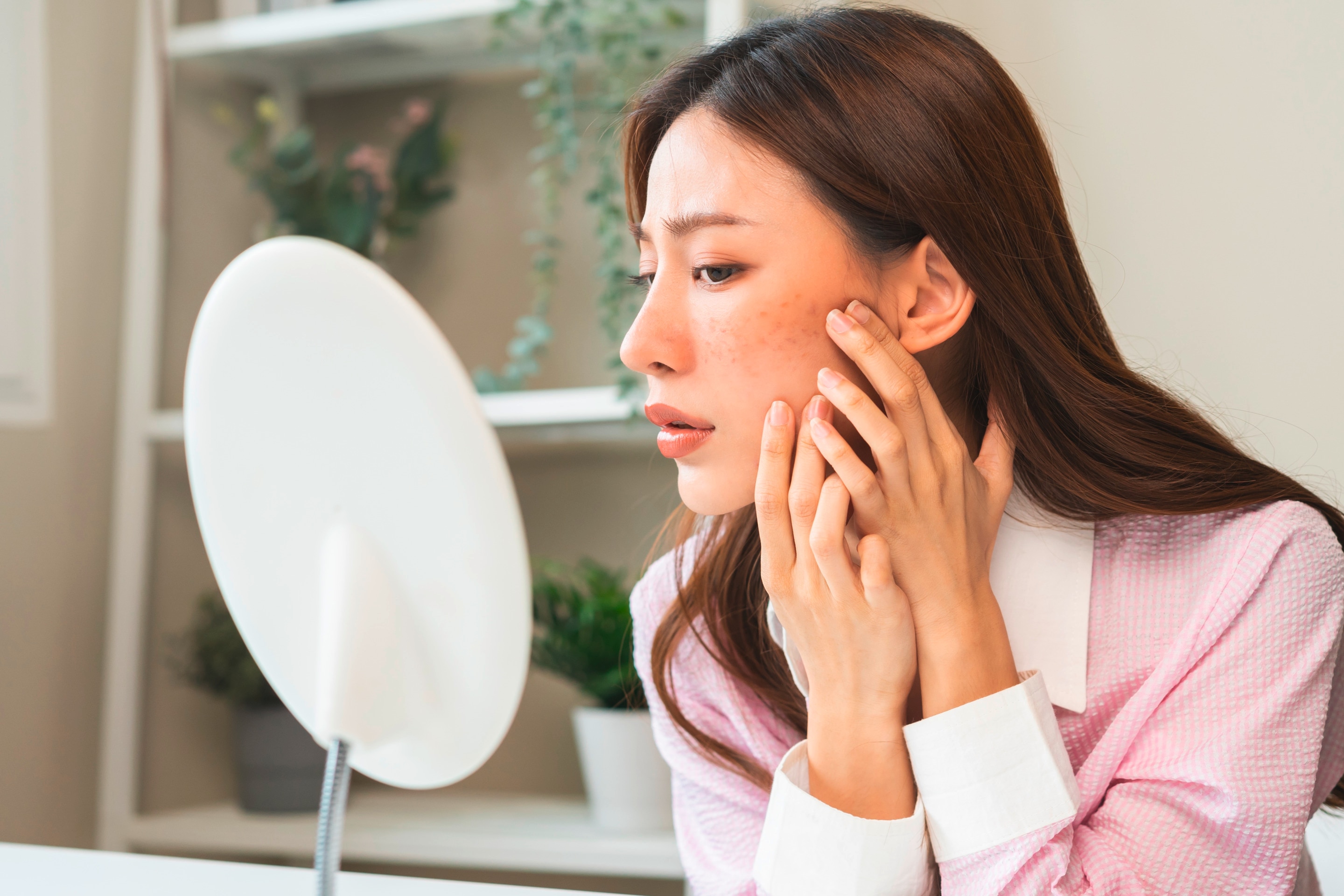 An Asian woman with acne looking at a table stand mirror.