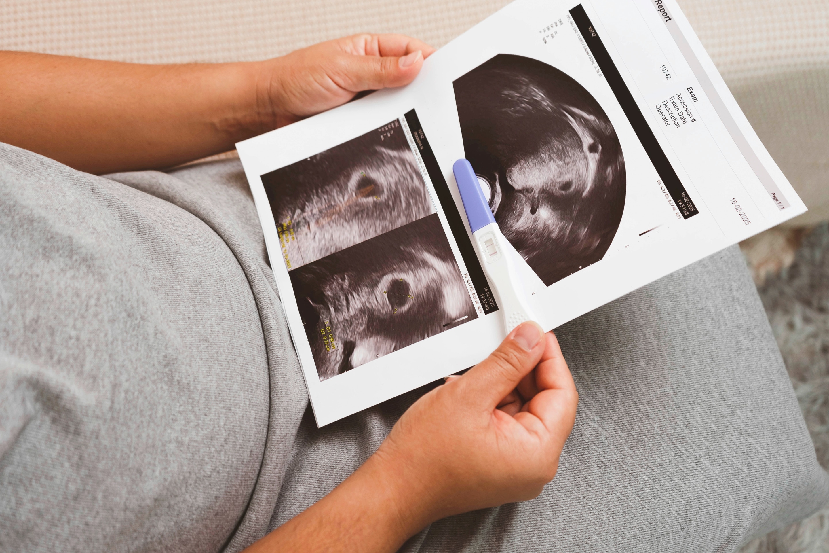 Seorang ibu sedang melihat hasil USG