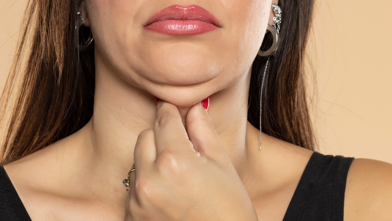 How This Connects to Facial Fat and Double Chin Concerns