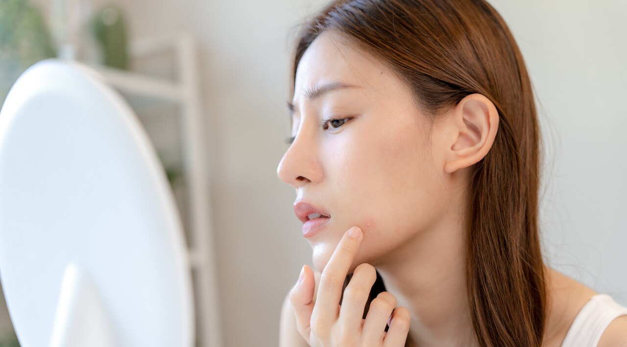 What a Cortisol Imbalance Looks Like on the Skin