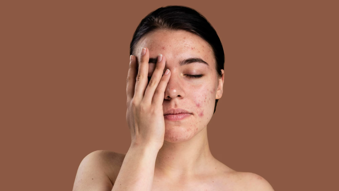 Best Pigmentation Removal Creams for Even Skin Tone