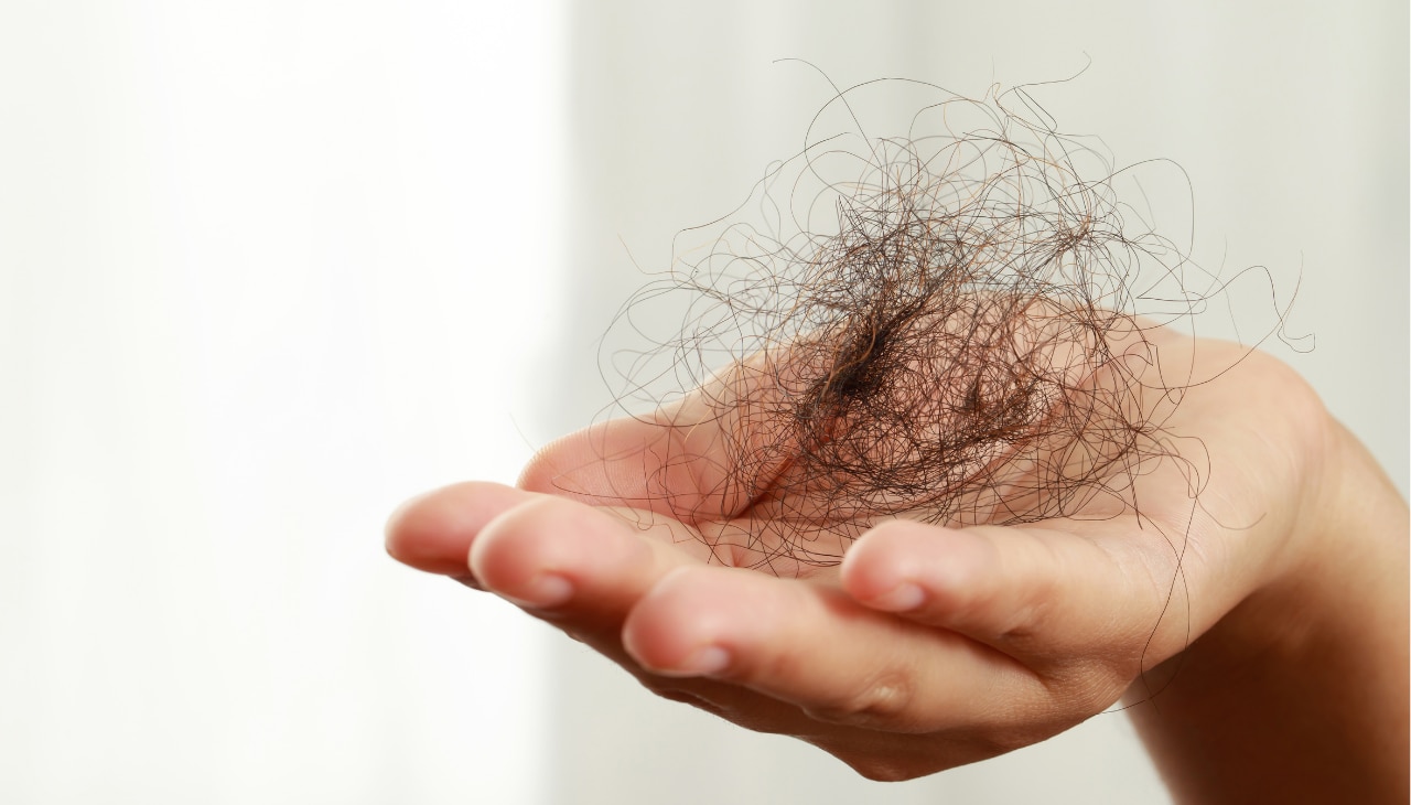 Causes of Hair Fall