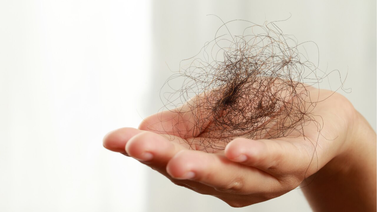 Causes of Hair Fall