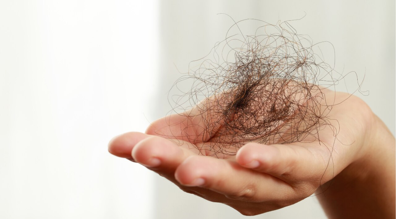 Causes of Hair Fall