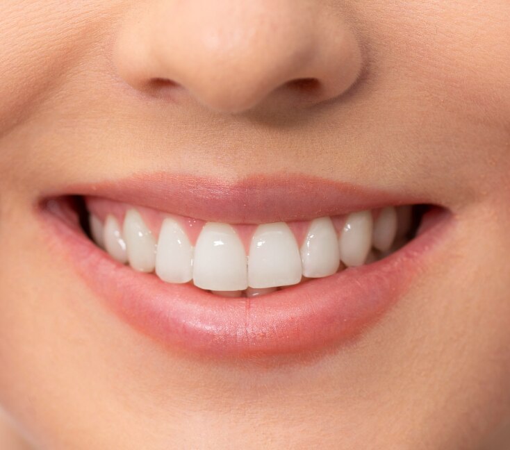 Image of Whitening Teeth at Home: Remedies, Before/After Expectations & Daily Care Tips