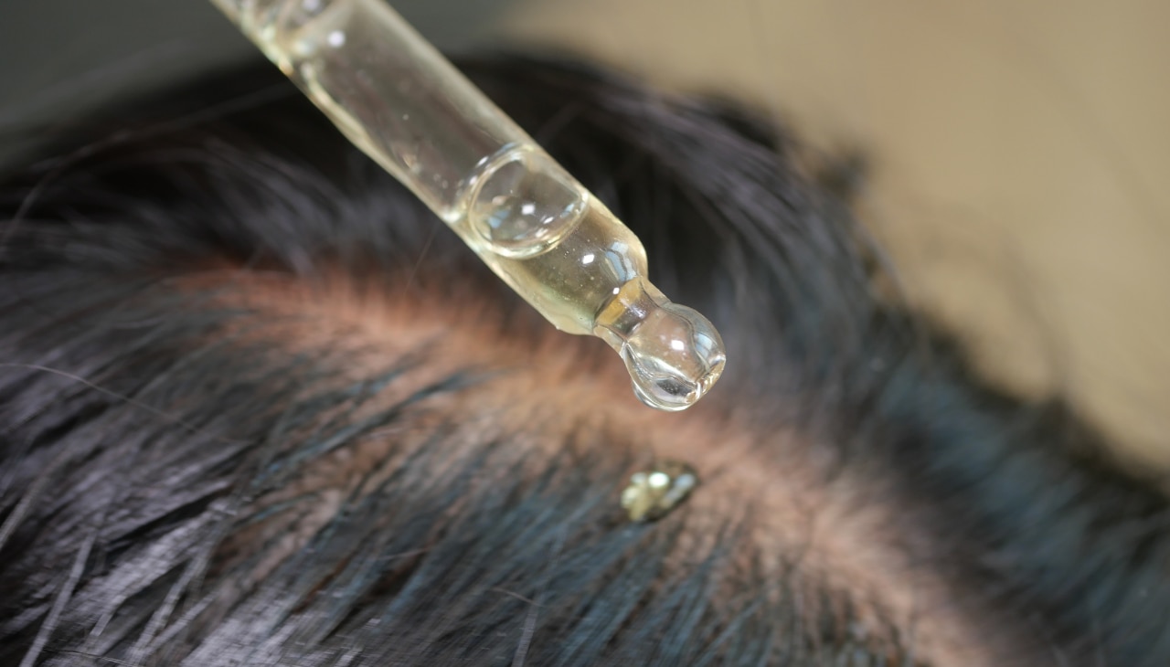 Benefits of Onion Hair Oil