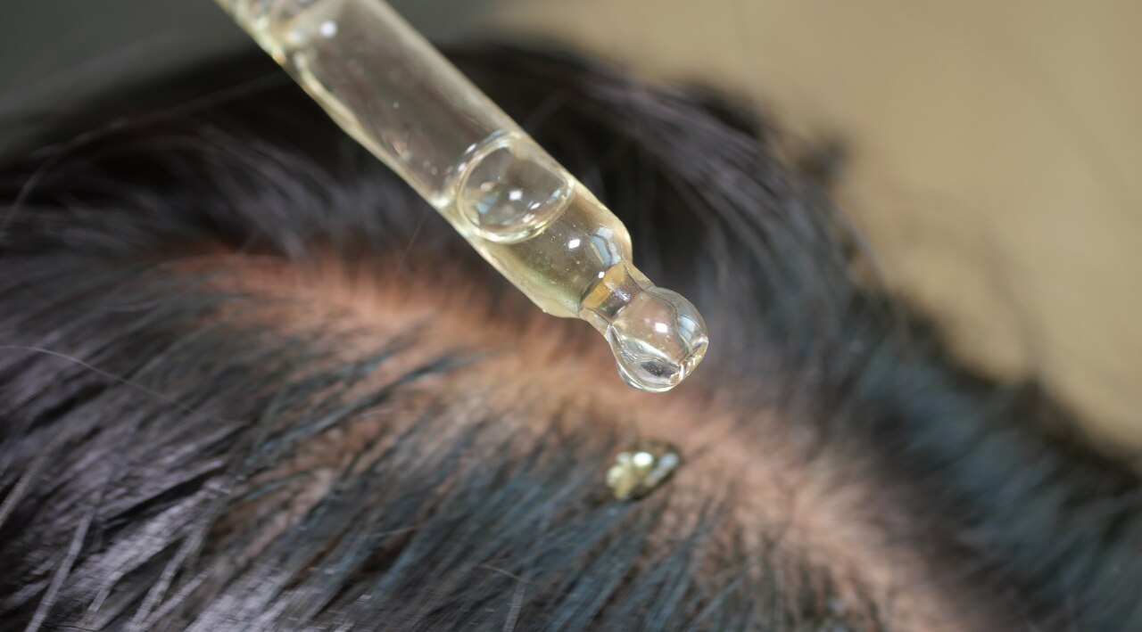 Benefits of Onion Hair Oil