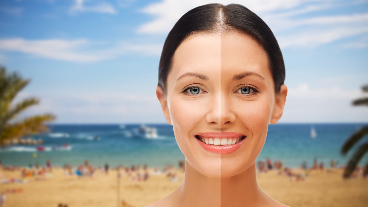 Causes of Tanning on the Face