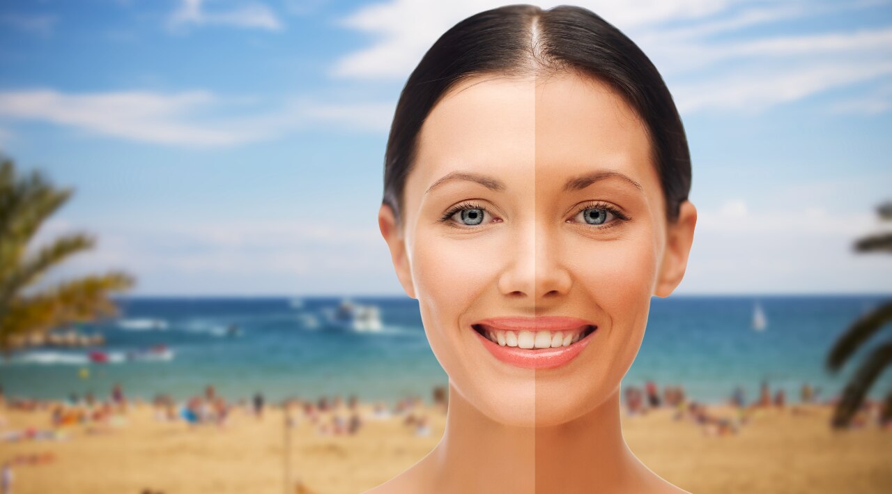 Causes of Tanning on the Face