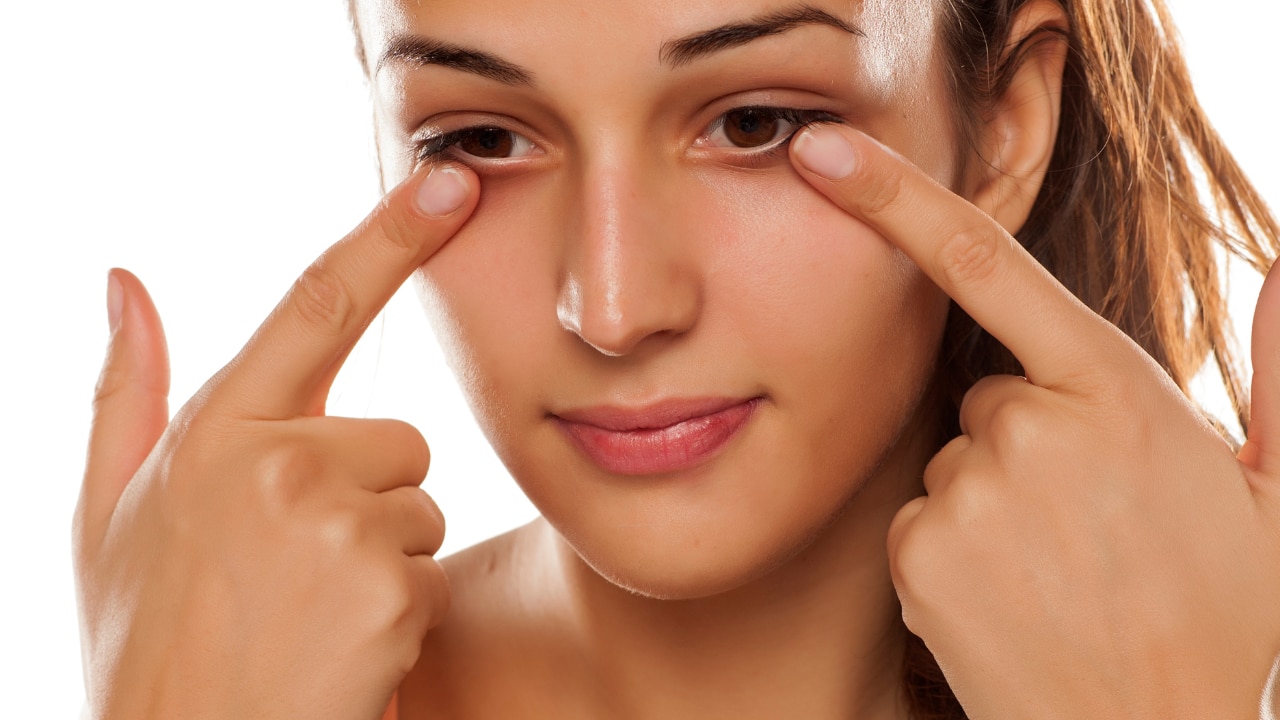 Types of Dark Circles (And How to Identify Yours)