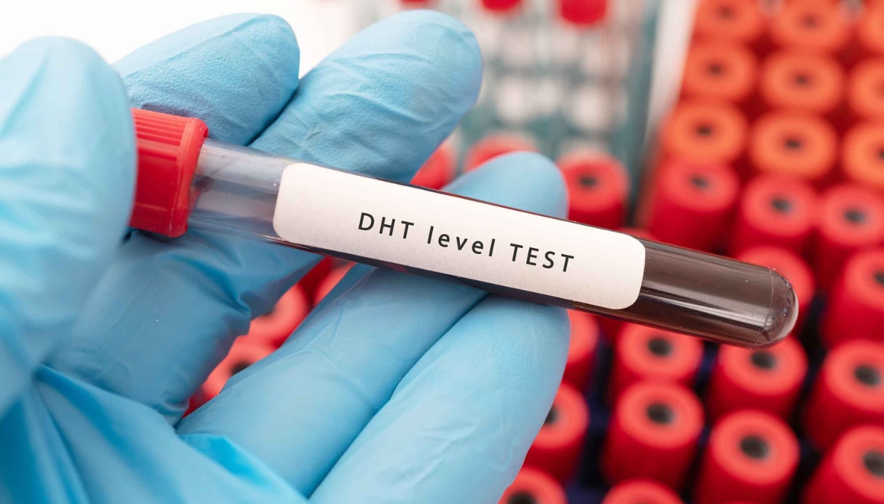 Blocks Dihydrotestosterone (DHT) Effects-